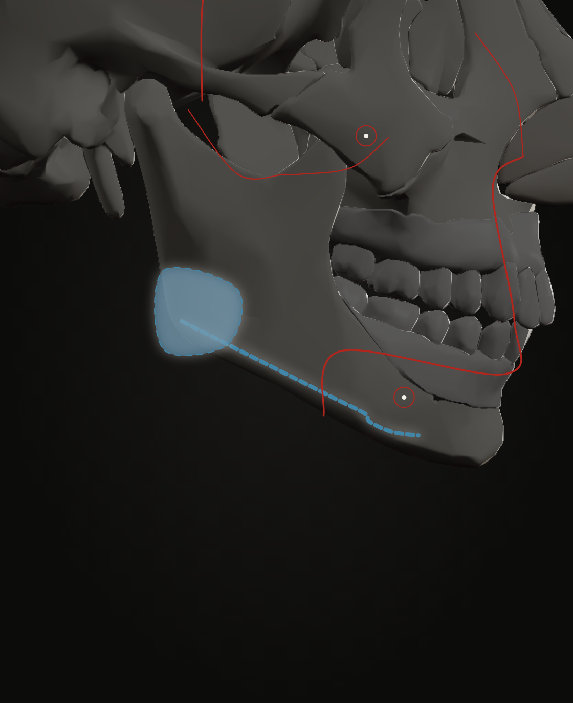 Link territory along the mandibular border of the reference skull, profile view, with the facial artery crossing