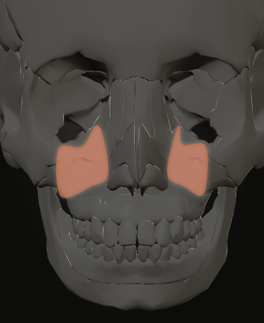 Uplift territory over the anterior maxilla on the reference skull, front view