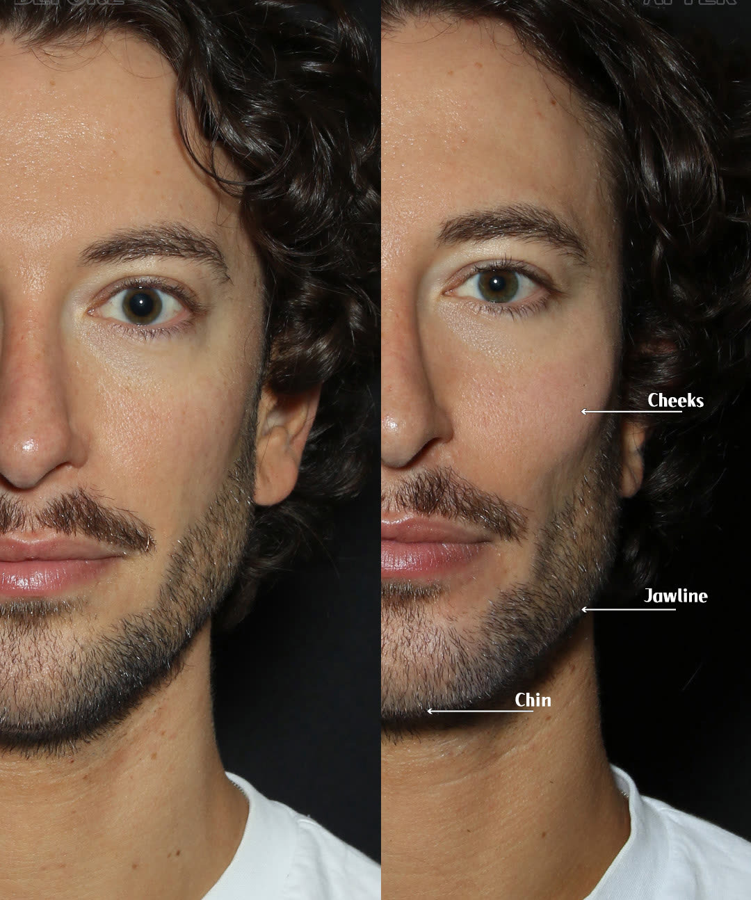Lower-third definition, unretouched