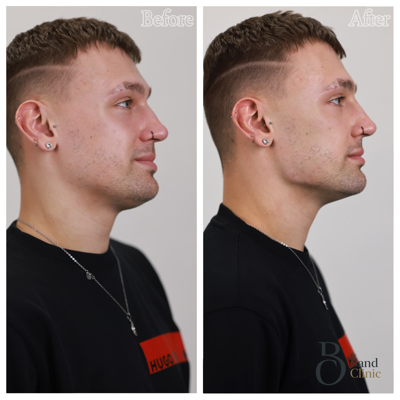 Mid-face and jaw balance, unretouched